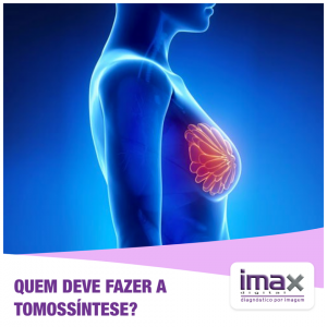 quem deve fazer a Tomossíntese