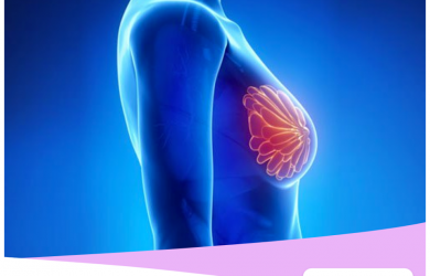 quem deve fazer a Tomossíntese